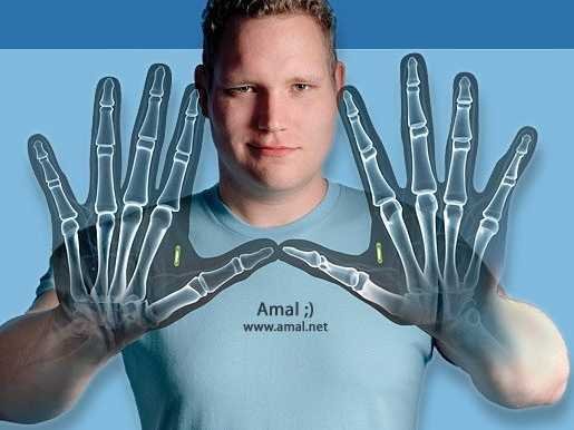 implantable app development